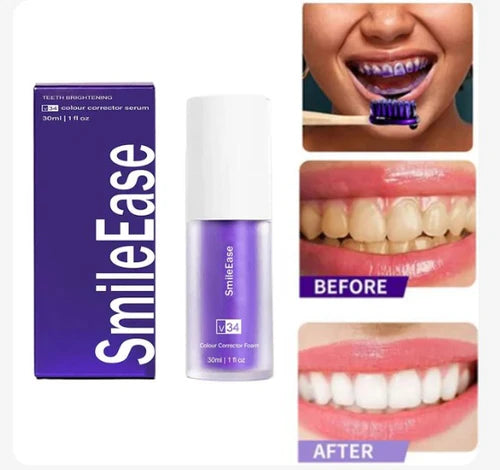 Compra 1 llévate 2 - QUEMA DE EXISTENCIAS HISMILE™ - Blanqueadora Dental Instantánea