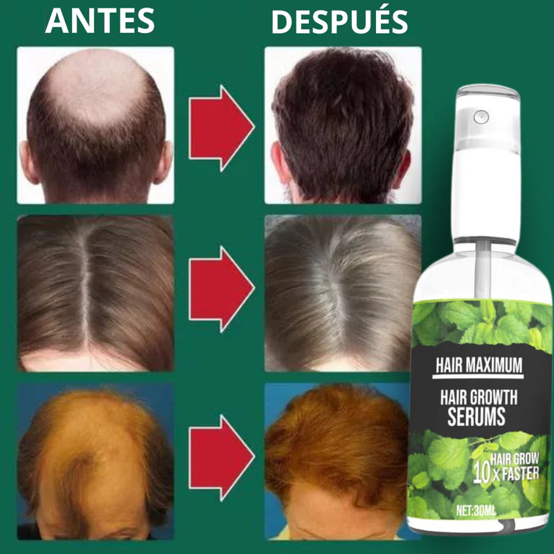 Spray para el cabello 2x1 - Fórmula americana HAIR GROWTH™