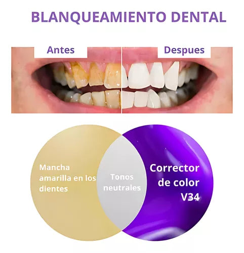 Compra 1 llévate 2 - QUEMA DE EXISTENCIAS HISMILE™ - Blanqueadora Dental Instantánea