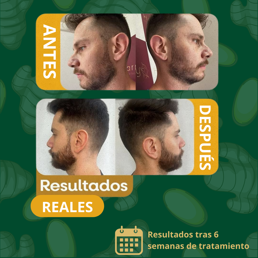 ¡50%! SPRAY GINGENG PARA CRECER EL PELO - PAGA 1 OTRO DE REGALO